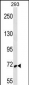 SYK Antibody