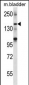 SHANK2 Antibody (Center)