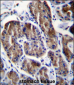 RPS4Y1 Antibody (Center)
