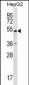 RNF38 Antibody (N-term)
