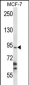 RBM28 Antibody (N-term)