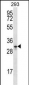 GPM6A Antibody (C-term)