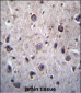 DOC2A Antibody (Center)