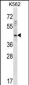 DOC2A Antibody (Center)