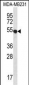 GPR34 Antibody (Center)