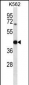 OXA1L Antibody (C-term)