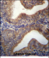 SLC29A3 Antibody (N-term)