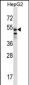 SLC29A3 Antibody (N-term)