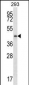 PTGR2 Antibody (N-term)