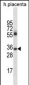 IGHG4 Antibody (Center)