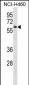 IRAK4 Antibody (N-term)