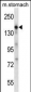 EGF Antibody (Center)