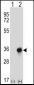 CBR3 Antibody (C-term)