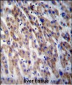 CPN1 Antibody (Center)