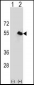 CPN1 Antibody (Center)