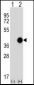 CTSK Antibody (Center E112)