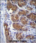 DCTN2 Antibody (Center)