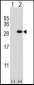 GSTT1 Antibody (N-term)