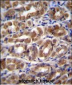 FABP2 Antibody (N-term)
