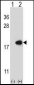 FABP2 Antibody (N-term)