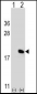 IL17A Antibody (Center)