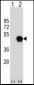 SERPINE1 Antibody (Center)