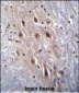 HIPK4 Antibody