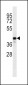 C9orf72 Antibody (C-term)