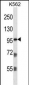 PKP2 Antibody (C-term)