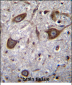 GRIA4 Antibody (Center)
