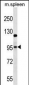 GRIA4 Antibody (Center)