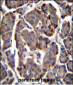 RAB11B Antibody (C-term)