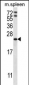 RAP1A Antibody (C-term)