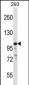 RASA1 Antibody (C-term)