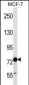 TLE4 Antibody (N-term)