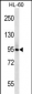 PLCD1 Antibody (N-term)