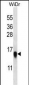 RPL35 Antibody (C-term)