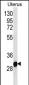 RNF148 Antibody (C-term)
