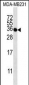 TAS2R1 Antibody (C-term)