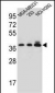 TAS2R1 Antibody (C-term)