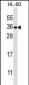 PITPNB Antibody (C-term)