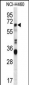 HERV-FRD Antibody (N-term)