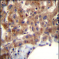 MBNL2 Antibody (C-term)