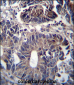 ZFYVE19 Antibody (C-term)