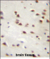 ANKRD6 Antibody (Center)