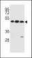 KREMEN2 Antibody (Center)