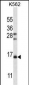 FSHB/FSH Antibody (Center)