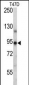 PGR/PR Antibody (Center)