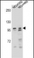 AR Antibody (Center)