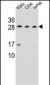 CD79A Antibody (C-term)